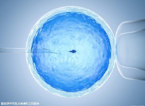 第三代试管婴儿